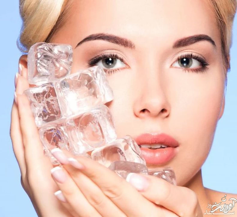 درمان جوش با یخ